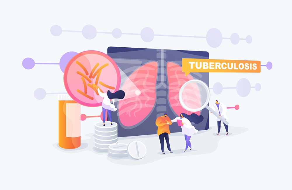 Pneumonia treatment, bronchitis cure. Respiratory contagious viral infection. Tuberculosis, mycobacterium tuberculosis, world tuberculosis day concept. Vector isolated concept creative illustration